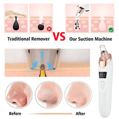 5-in-1 Electric Blackhead Remover – USB Rechargeable Derma Suction Facial Cleanser | Deep Pore Cleansing & Dead Skin Removal for All Skin Types