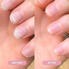 Radiant Nail Growth Oil Pen – Strengthening & Brightening Nail Care Treatment